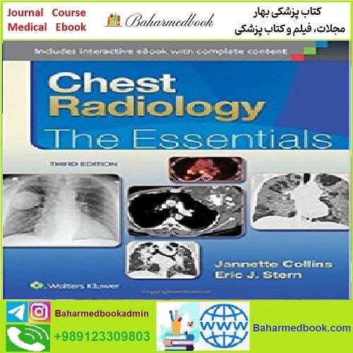 Chest Radiology The Essentials CONVERTEF PDF price 1€ - کتاب پزشکی بهار