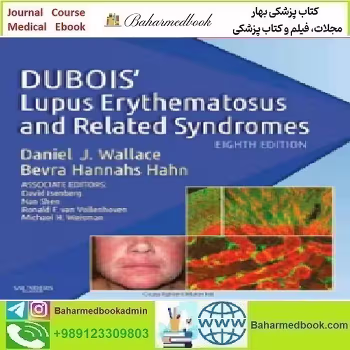 Dubois' Lupus Erythematosus and Related Syndromes 2013
