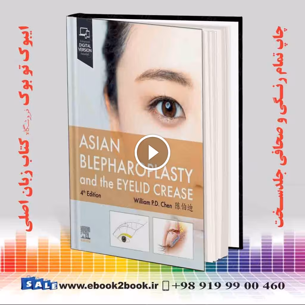 Asian Blepharoplasty and the Eyelid Crease 4th Edition