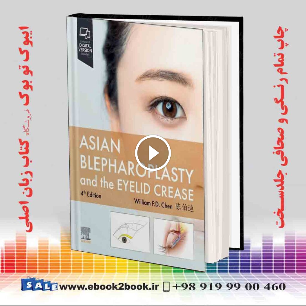 Asian Blepharoplasty and the Eyelid Crease 4th Edition