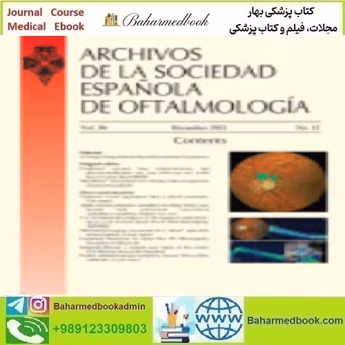 Archivos de la Sociedad Española de Oftalmología English Editio