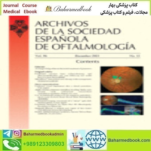 Archivos de la Sociedad Española de Oftalmología English Editio