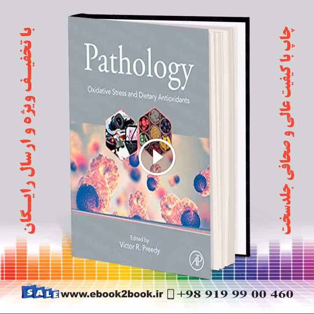 Pathology: Oxidative Stress and Dietary Antioxidants