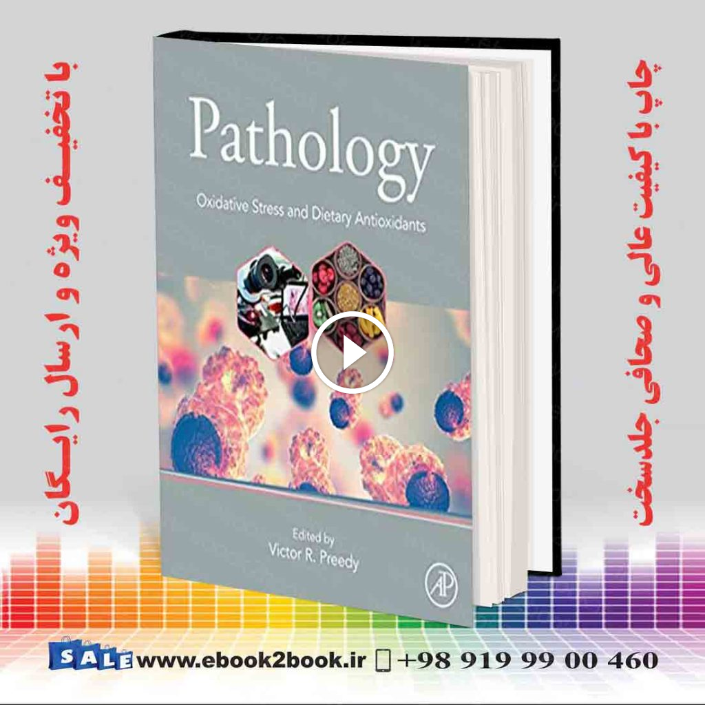 Pathology: Oxidative Stress and Dietary Antioxidants