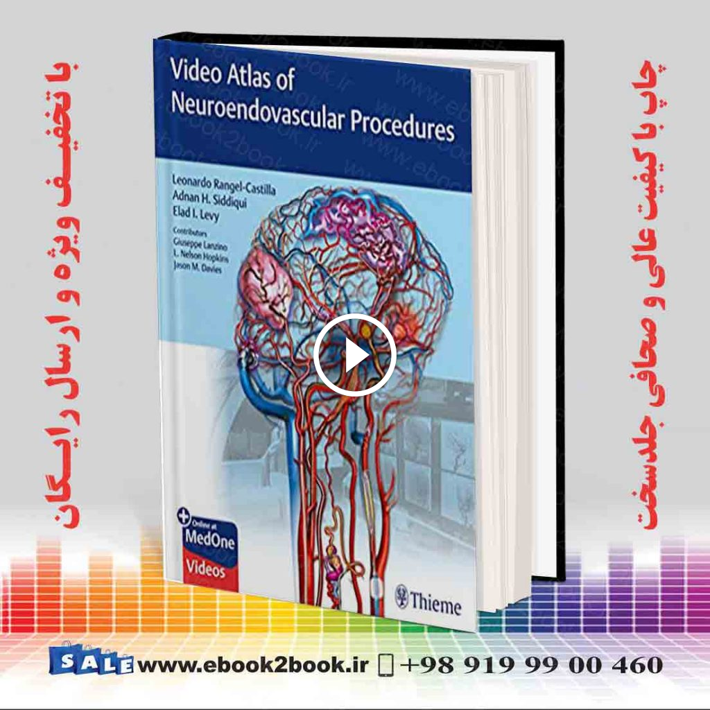 Video Atlas of Neuroendovascular Procedures