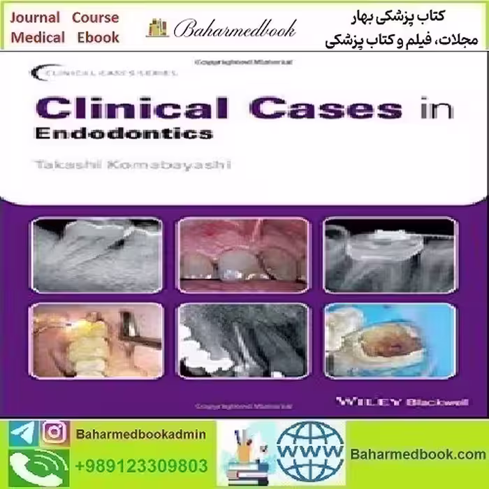 Clinical Cases in Endodontics 2018 TRUE PDF price 1€ - کتاب پزشکی بهار