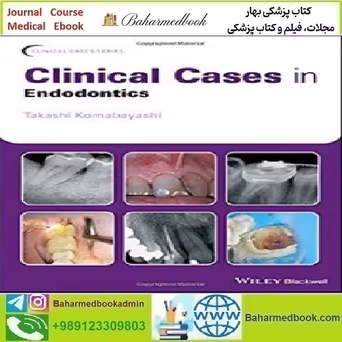 Clinical Cases in Endodontics 2018 TRUE PDF price 1€ - کتاب پزشکی بهار