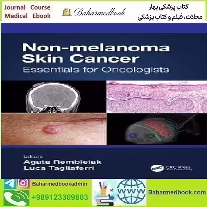 Non melanoma Skin Cancer