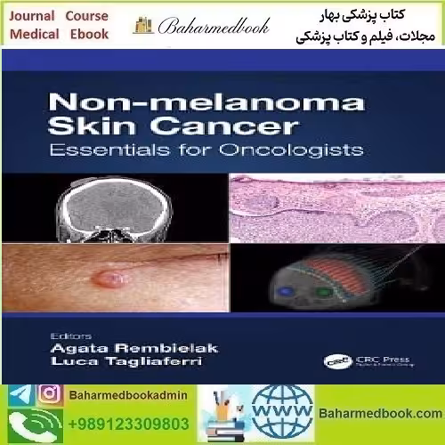 Non melanoma Skin Cancer