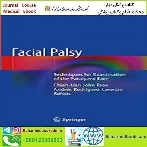 Facial Palsy Techniques for Reanimation of the Paralyzed Face 202
