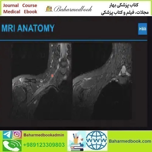 Plexus and Peripheral Nerve Imaging 2024 video course price 60€ - کتاب پزشکی بهار