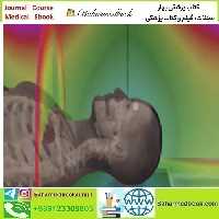 ARRS Understanding MR Safety Through AI Software Simulatio