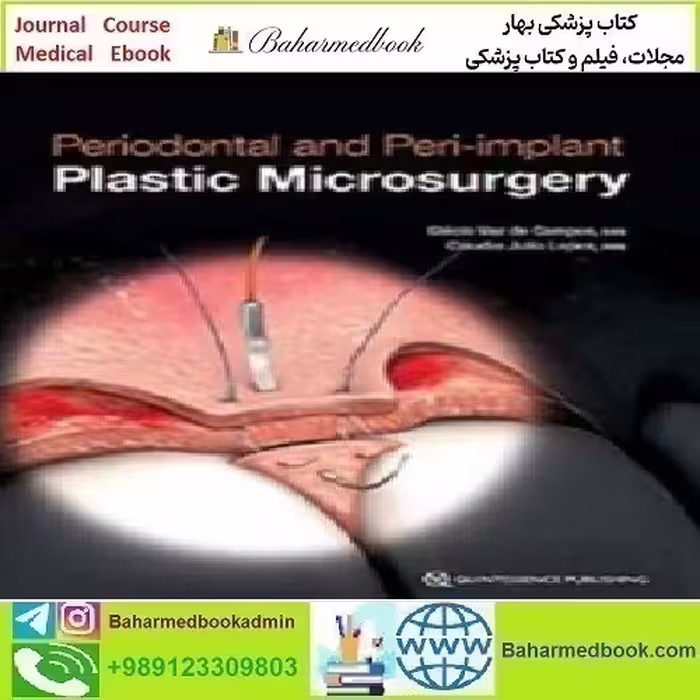 Periodontal and Peri implant Plastic Microsurgery 2021 TRUE P