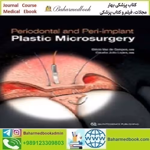 Periodontal and Peri implant Plastic Microsurgery 2021 TRUE P