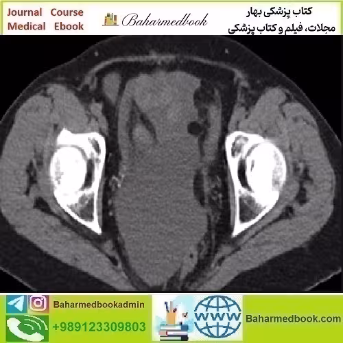 Radiologic Reasoning A Rapid Fire Multispecialty Review 2018 vi