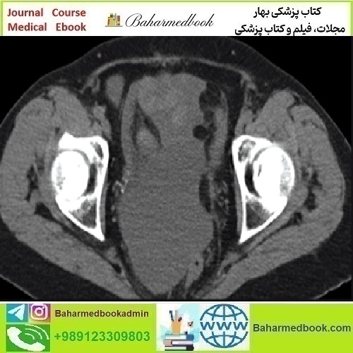 Radiologic Reasoning A Rapid Fire Multispecialty Review 2018 vi