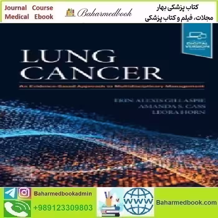 Lung Cancer An Evidence Based Approach to Multidisciplinary M