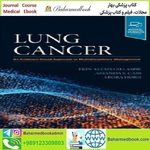 Lung Cancer An Evidence Based Approach to Multidisciplinary M