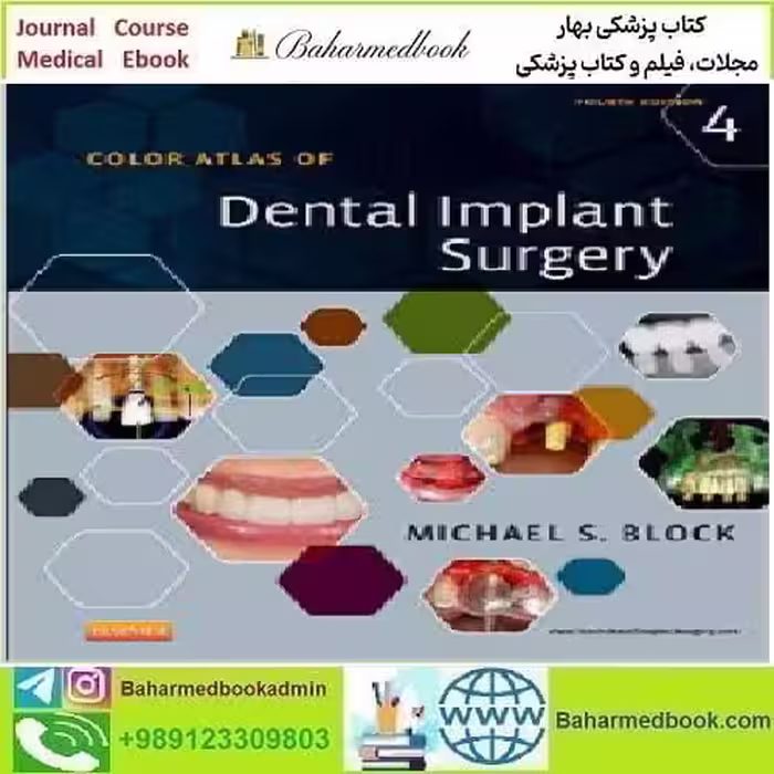Color Atlas of Dental Implant Surgery 2014