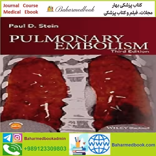 Pulmonary Embolism TRUE PDF price 1€ - کتاب پزشکی بهار