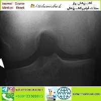 Musculoskeletal Imaging for the Practicing Radiologist 2018 video