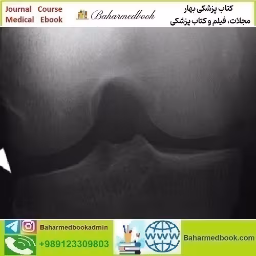 Musculoskeletal Imaging for the Practicing Radiologist 2018 video