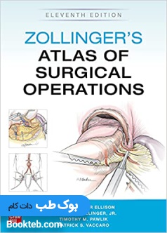 Zollinger&#039;s Atlas of Surgical Operations