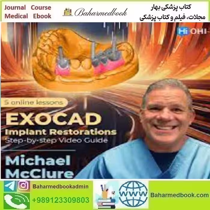 OHI S EXOCAD Implant Restorations Step by step Video Guide 20