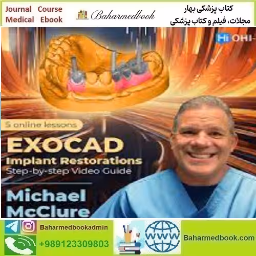 OHI S EXOCAD Implant Restorations Step by step Video Guide 20