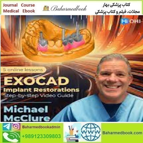 OHI S EXOCAD Implant Restorations Step by step Video Guide 20