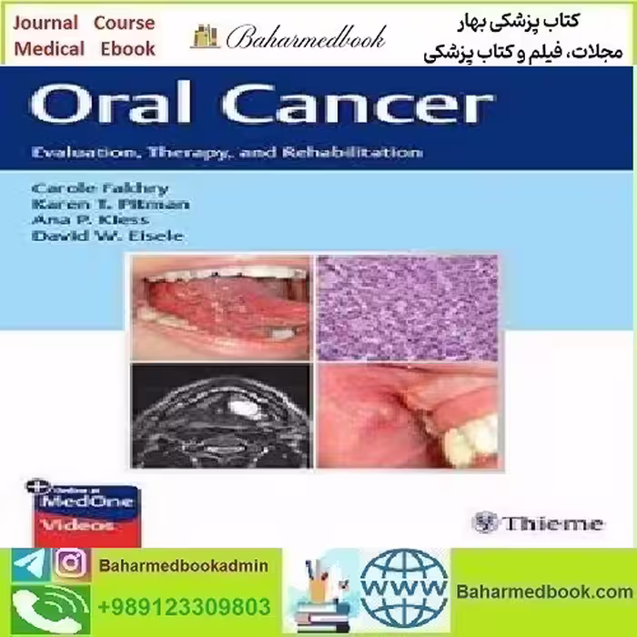 Oral Cancer Evaluation Therapy and Rehabilitation 2020