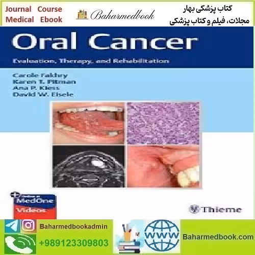 Oral Cancer Evaluation Therapy and Rehabilitation 2020