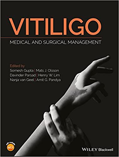 Vitiligo Medical and Surgical Management 2018, - کتاب پزشکی بهار