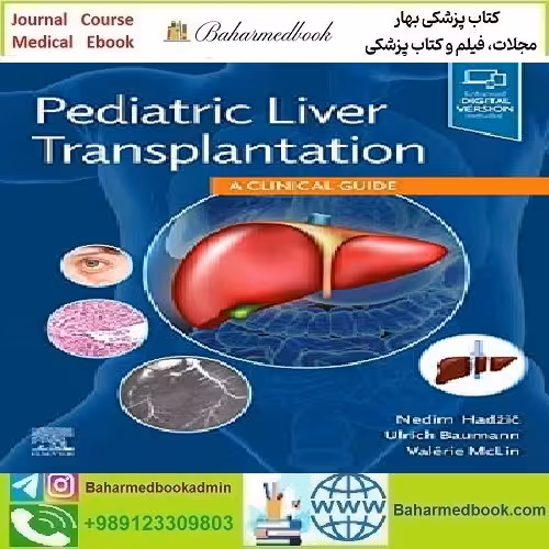 Pediatric Liver Transplantation A Clinical Guide 2021