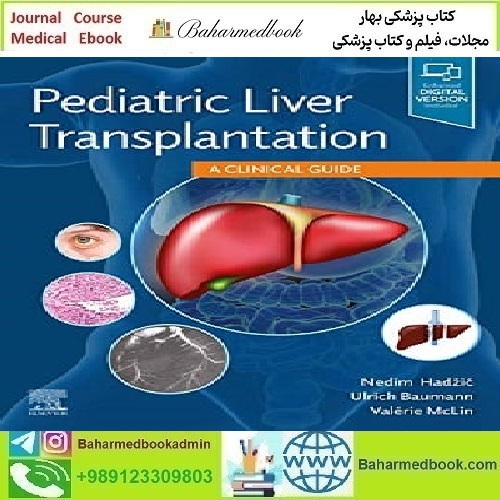 Pediatric Liver Transplantation A Clinical Guide 2021