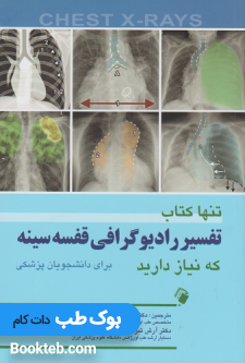 تنها کتاب تفسیر رادیوگرافی قفسه سینه که نیاز دارید