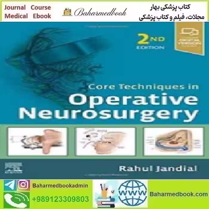 Core Techniques in Operative Neurosurgery 2020 TRUE