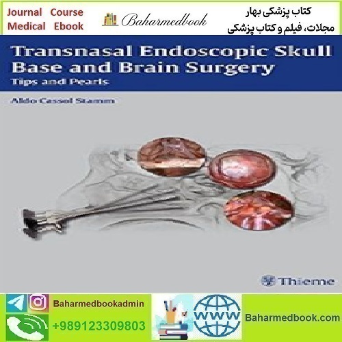 Transnasal Endoscopic Skull Base and Brain Surgery 2011 T