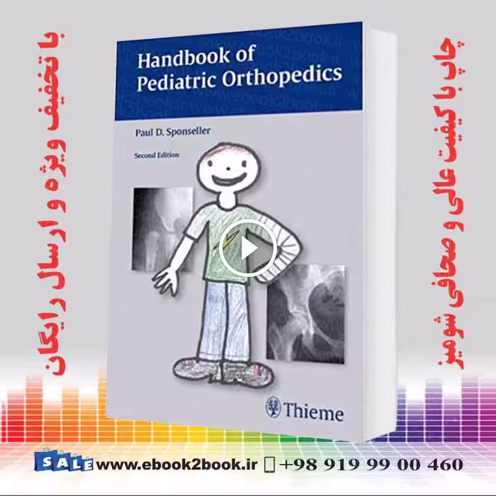 Handbook of Pediatric Orthopedics 2nd Edition