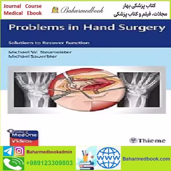 Problems in Hand Surgery TRUE PDF price 1€