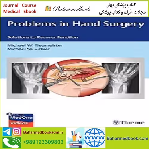 Problems in Hand Surgery TRUE PDF price 1€