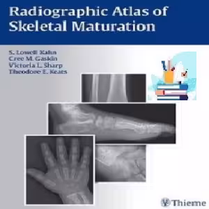 Radiographic Atlas of Skeletal Maturation TRUE PDF price 1€