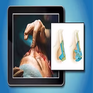 QMP e Learning Program – plastic surgery at 135€ - کتاب پزشکی بهار
