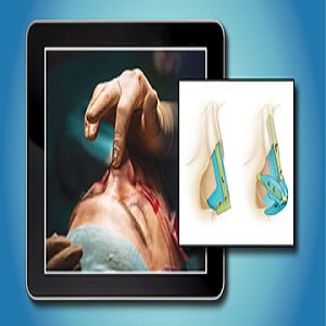 QMP e Learning Program – plastic surgery at 135€ - کتاب پزشکی بهار
