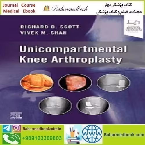 Unicompartmental Knee Arthroplasty 2023 TRUE PDF price 2€ - کتاب پزشکی بهار