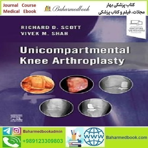 Unicompartmental Knee Arthroplasty 2023 TRUE PDF price 2€ - کتاب پزشکی بهار