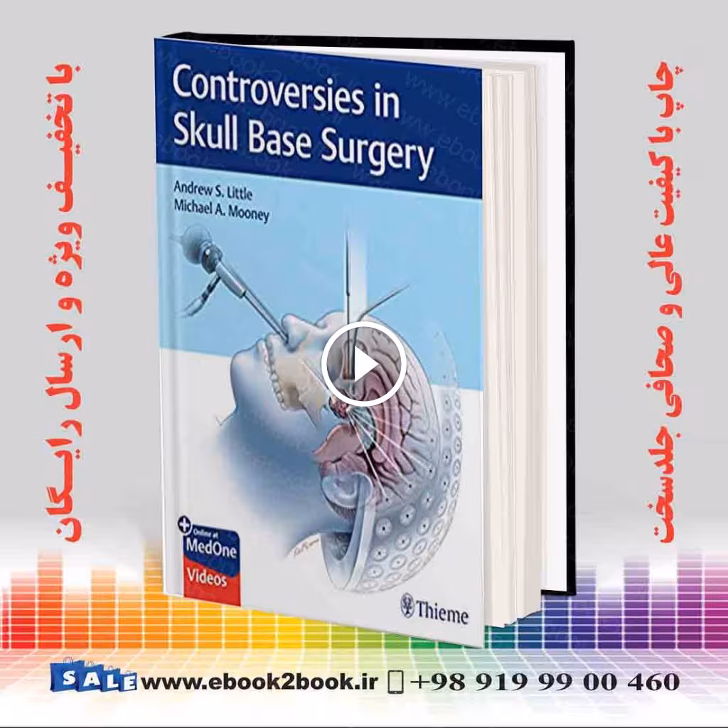 Controversies in Skull Base Surgery