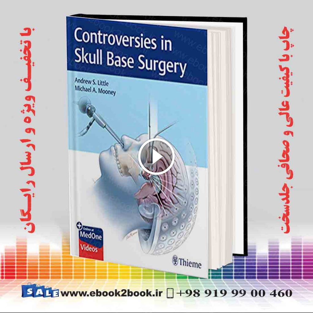 Controversies in Skull Base Surgery