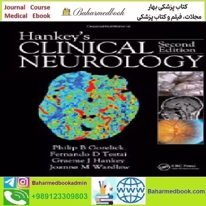 Hankey's Clinical Neurology 2014 TRUE PDF price 1€ - کتاب پزشکی بهار