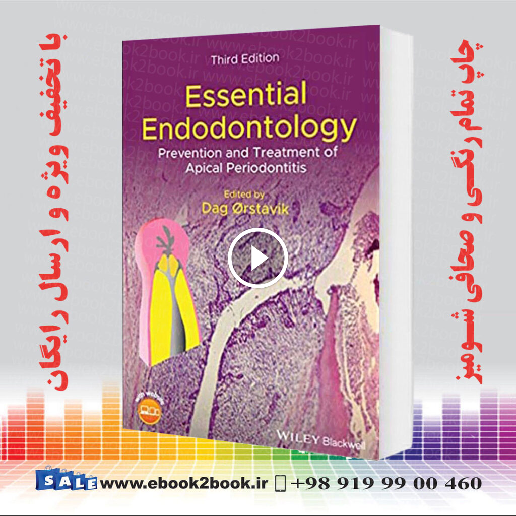 Essential Endodontology 3rd Edition